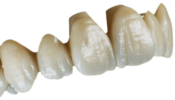 prothèses_dentaires_disque_zircone_cylab_prothese_dentaire