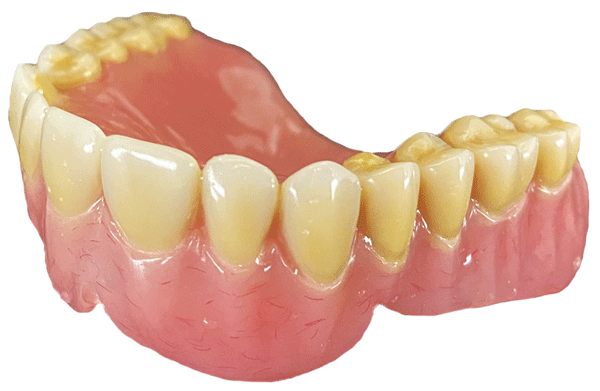 prothese_resine_immediate_bas - prothèse dentaire