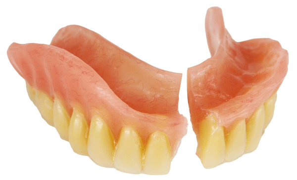 reparation - prothèse dentaire