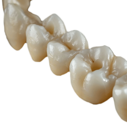 prothèses_dentaires_transvissee_cylab_prothese_dentaire